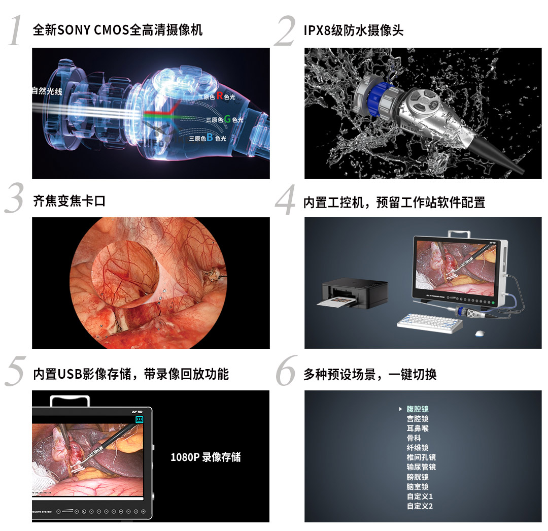 內(nèi)窺鏡攝像系統(tǒng)YKD-9115